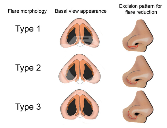 Basal View of the Nose