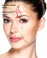 Stock facial arteries danger zone 1 brow