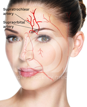 Stock facial arteries danger zone 1 brow