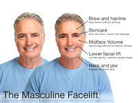 Male-facial-plastic-surgery