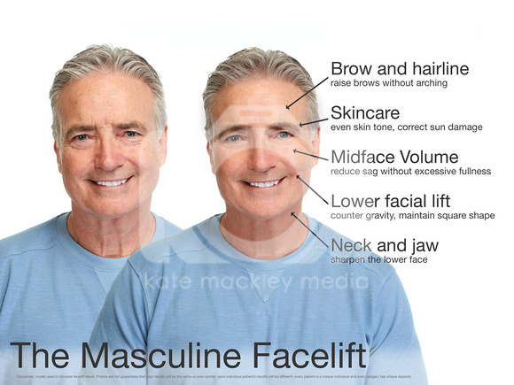 Male-facial-plastic-surgery